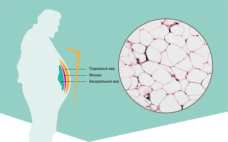 Белая жировая ткань состоит из специализированных клеток-адипоцитов. Почти весь адипоцит заполняет жировая капля, окруженная ободком цитоплазмы с клеточным ядром. При нервной или гуморальной стимуляции адипоциты высвобождают жирные кислоты и глицерин. Public Domain