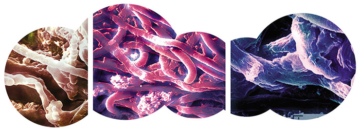 Cyanobacteria Microcoleus chtonoplastes from saline lagoons of Sivash (Crimea): Successive stages of fossilization. Photograph by L. Gerasimenko (Institute of Microbiology, Moscow)