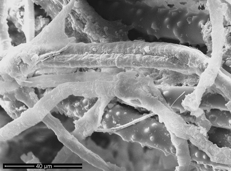 Благодаря сканирующей электронной микроскопии в теле больной байкальской губки можно увидеть нитчатые цианобактерии, проникшие между спикулами – скелетными элементами губок