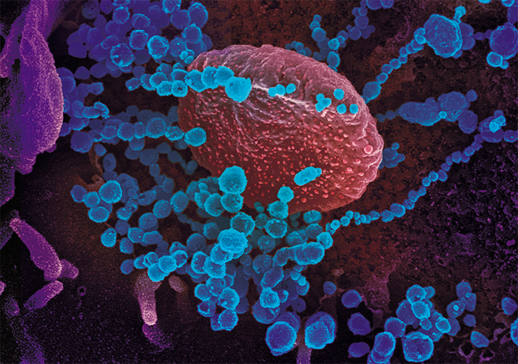 Вирусные частицы SARS-CoV-2 (синие объекты) в лабораторной культуре. Штамм выделен от пациента в США. Сканирующая электронная микроскопия © NIAID