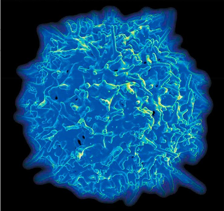 человеческий Т-лимфоцит – одна из важнейших составляющих нового иммунного оружия против раковых клеток. Растровая микроскопия. Credit: National Institute of Allergy and Infectious Diseases, USA