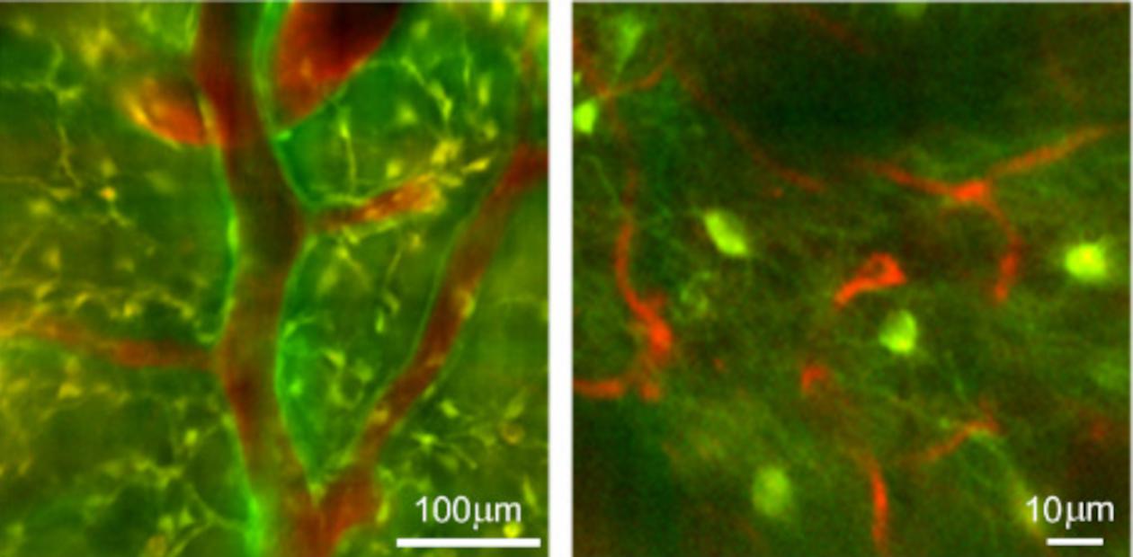 Двухфотонная микроскопия мозга мыши. Слева – нейроны, окрашенные чувствительным к кальцию зеленым красителем, справа – нейроны трансгенной мыши, производящие зеленый флуоресцентный белок. Сосуды окрашены «техасским красным»