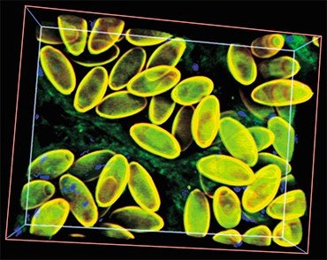 Трехмерная реконструкция яиц описторха в дистальной части матки паразитической трематоды. Под микроскопом яйца разных видов описторхид практически неразличимы между собой, поэтому диагностика паразита по результатам микроскопического анализа лабораторного материала от зараженных людей носит субективный характер. Лазерная сканирующая микроскопия
