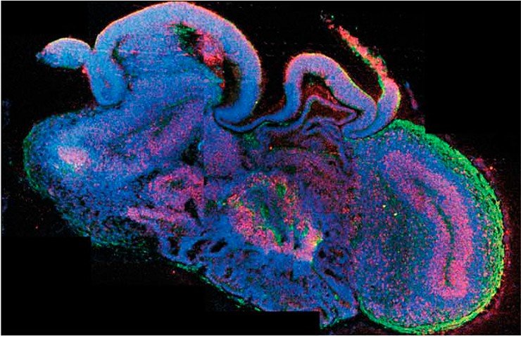 Первые трехмерные структуры, выращенные из индуцированных плюрипотентных стволовых клеток, по сути, представляют собой минимозг. На поперечном разрезе такого церебрального органоида с помощью флуоресцентного иммуногистохимического окрашивания можно выделить различные структуры. В правой части находятся ткани коры головного мозга; в нижней – сосудистое сплетение, складчатая структура, вырабатывающая спинномозговую жидкость. Стволовые клетки окрашены красным цветом, нейроны – зеленым, ядра клеток – синим. Credit: IMBA/ Madeline A. Lancaster 