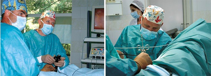 Этапы операции по методике N.O.T.E.S., которую проводят новосибирские врачи – проф. В. В. Анищенко и проф. А. И. Шевела