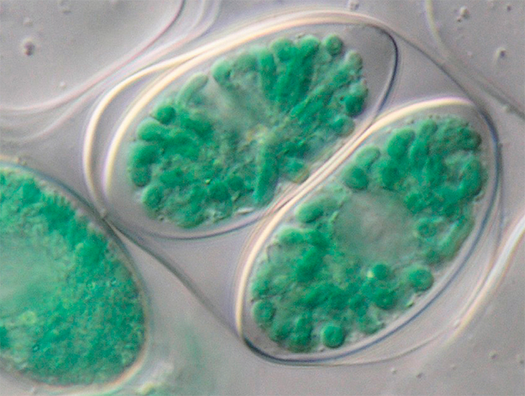 В клетках глаукофитовых водорослей Glaucocystis nostochinearum видны пластиды с голубыми пигментами. © CENTRAL DATACORE