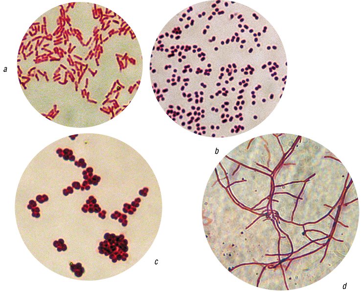 Hydrocarbon oxidizing microorganisms inhabiting Baikal are distinguished by their great taxonomic and morphological variety: а) Rhodococcus sp.; b) Acinetobacter sp.; c) Micrococcus sp.; d) Micromonospora sp. Light microscopy 