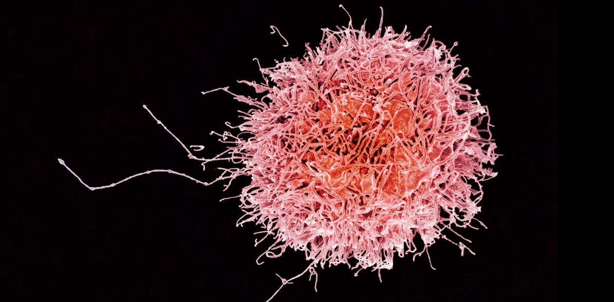 NK-клетка (натуральный киллер) – цитотоксический лимфоцит человека.  Сканирующая электронная микроскопия. © NIAID
