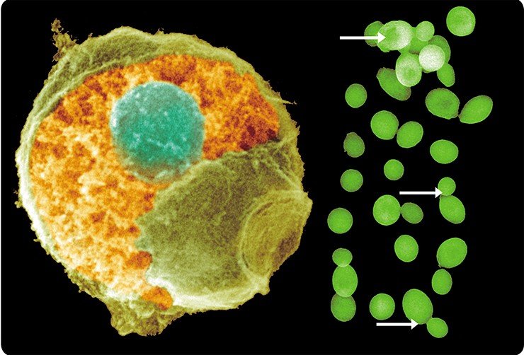 Слева: дрожжевая клетка с удаленным фрагментом клеточной оболочки. Видно округлое ядрои цитоплазматические структуры. Справа: дрожжевые клетки под световым микроскопом. Стрелками показаны почкующиеся дрожжи