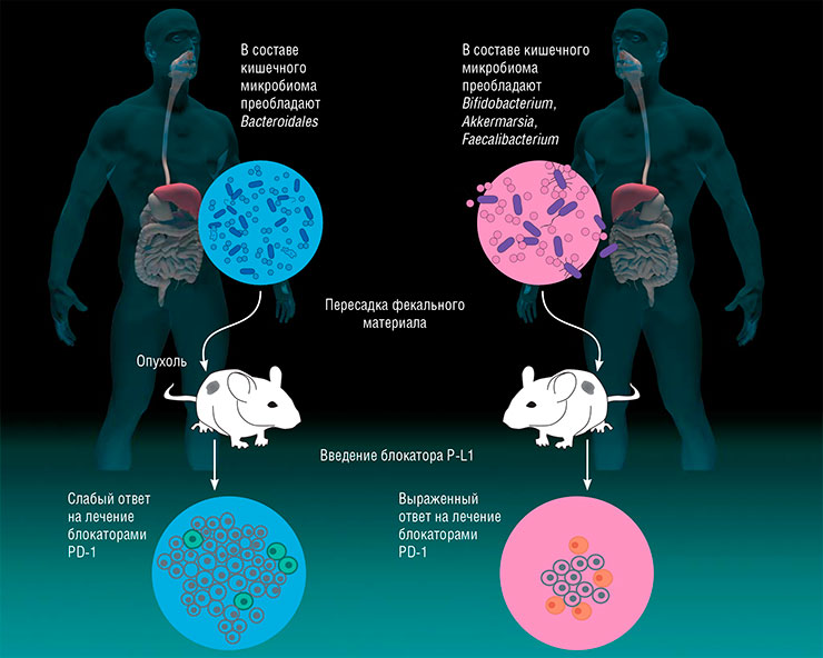 Иммунотерапия рака с помощью антител, блокирующих белок P-L1, зависит от структуры кишечного микробиома пациента. Это было подтверждено в опытах на стерильных мышах, которым пересаживали фекальный трансплантат от больных людей. По: (Modica, Gargari, Regondi et al., 2021)