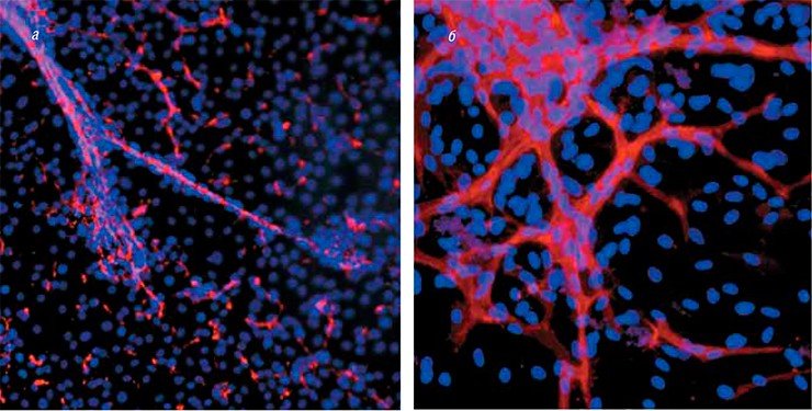 Для создания тканеинженерных конструкций сосудистого трансплантата новосибирские исследователи используют два источника клеток: биопсийный материал, а также эмбриональные и индуцированные плюрипотентные стволовые клетки человека, подвергнутые дифференцировке: а – сосудоподобные структуры, полученные в результате направленной кардиоваскулярной дифференцировки индуцированных плюрипотентных стволовых клеток; б – сосудоподобные структуры, образованные эндотелиальными клетками, выделенными из тканевых кардиальных образцов. Флуоресцентная микроскопия. Фото авторов