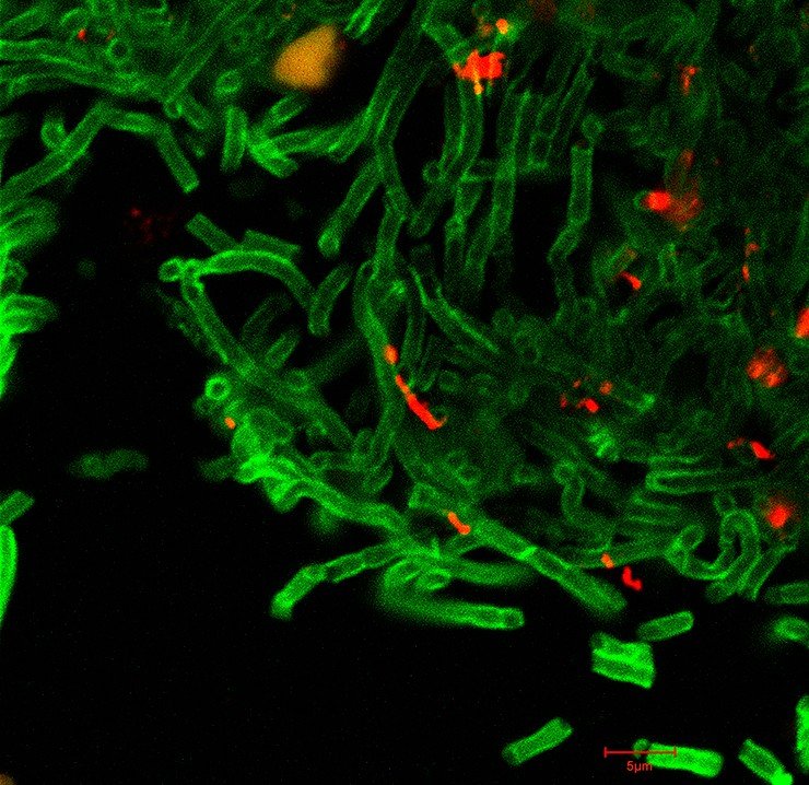 На микрофотографии, сделанной с использованием конфокальной флуоресцентной микроскопии, клеточные стенки бацилл Bacillus anthracis окрашены в зеленый цвет, а споры - в красный. CDC, Public Domain