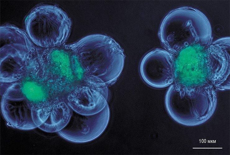 На фотографиях показаны микроносители со стволовыми клетками (зеленый). Размножение стволовых клеток позволит точнее охарактеризовать эти редкие объекты, а в дальнейшем и оценить их лечебный потенциал