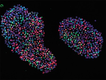 Колонии ИПСК, окрашенные антителами к транскрипционным факторам c-Myc и Nanog. Флуоресцентная микроскопия. Фото А. Богомазовой