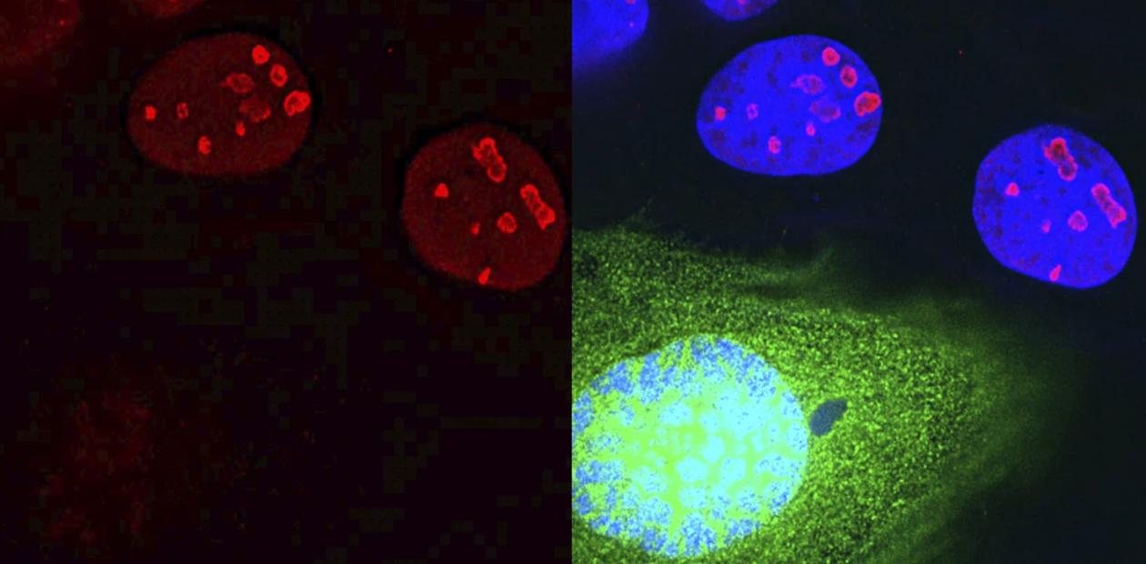 Белок CCDC137 (красным цветом), необходимый для деления клеток, истощен в клетках, инфицированных ВИЧ-1 (справа, зеленым цветом). © CC BY 4.0/ Zhang and Bieniasz