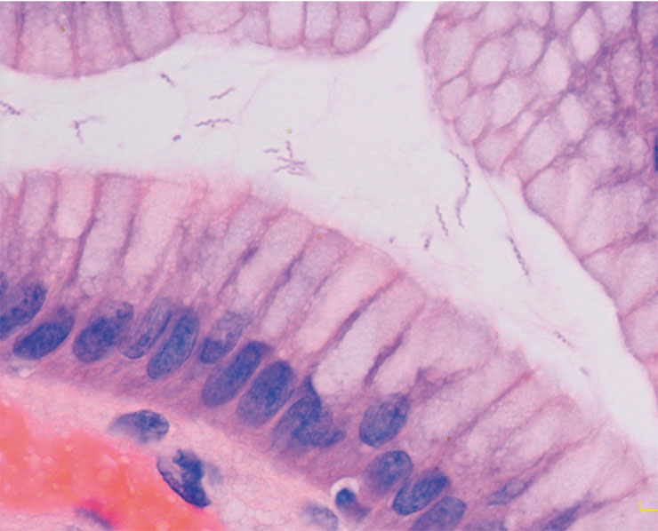 Бактерия Helicobacter heilmanii в биопсийном образце из антрального отдела желудка. © CC BY-SA 3.0/cnicholsonpath
