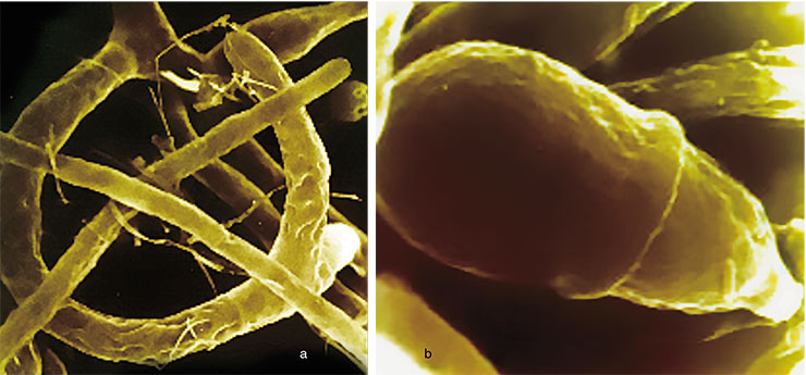 Trap (a) and conidia, the reproduction organ, (b) of the predatory fungi of the species Arthrobotrys oligospora. The author of the strain is T. Tepliakova. Electronic microscope