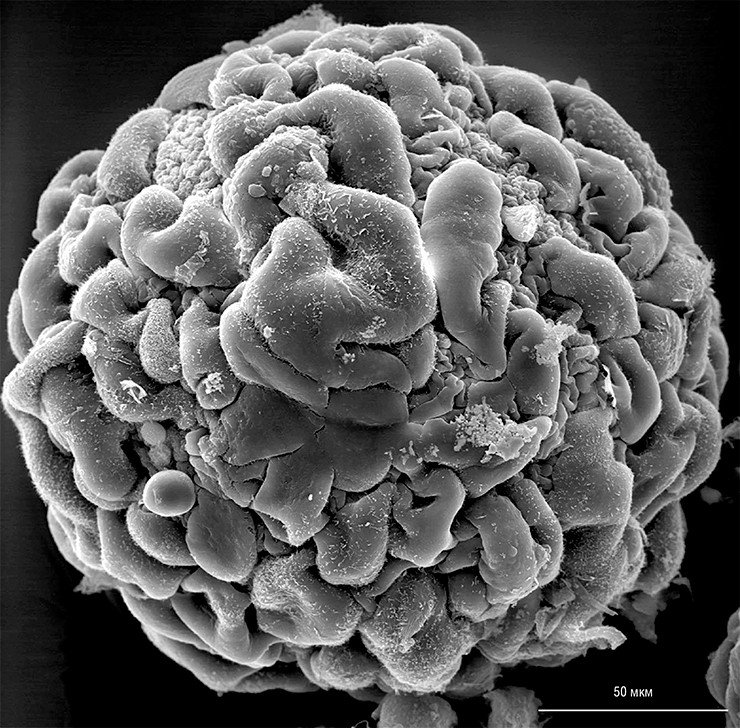 Фотография была получена с помощью сканирующего электронного микроскопа и показывает, как густо миобласты покрывают поверхность микроносителя