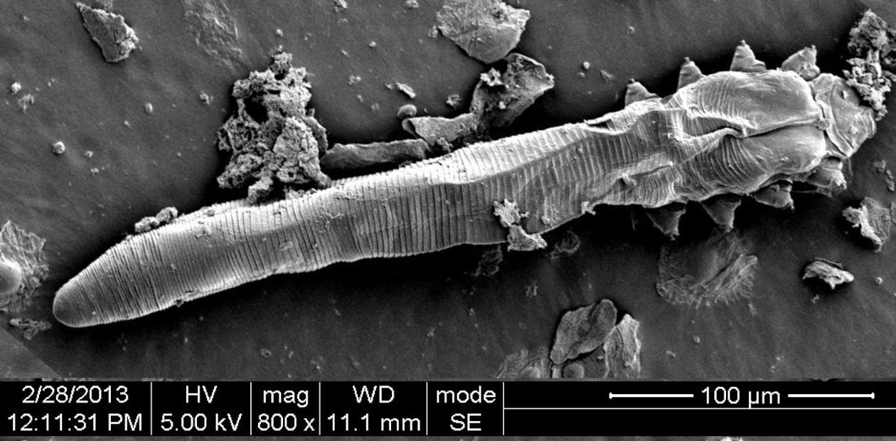 Demodex folliculorum, сканирующая электронная микроскопия