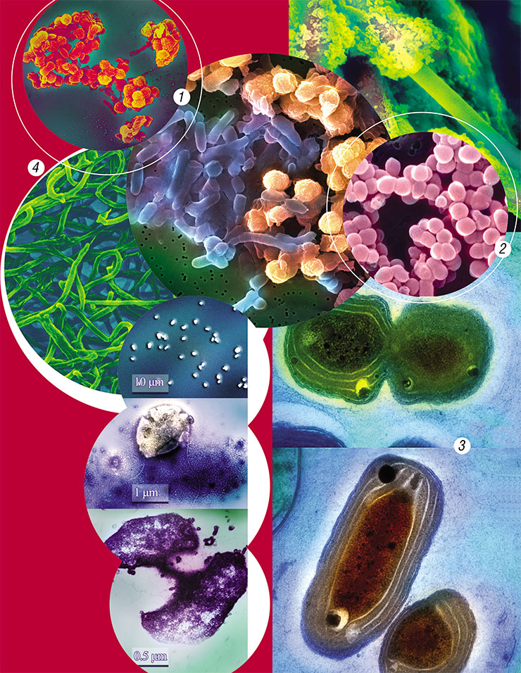 Methane-producing archaebacteria Methanosalsum zhilinae from sodic lakes of Tuva (bottom left). Photograph by T. Zhilina (Institute of Microbiology, Moscow). Microorganisms from Lake Baikal: (1) Fe and Mn oxidizing bacteria from bottom sediments; (2, 3) picoplankton; (4) air mycelium of actinomycete Streptomyces sp. Photograph by Yu. Zakharova (1), I. Tikhonova (2, 3), I. Terkina (4) (Limnological Institute, Irkutsk)