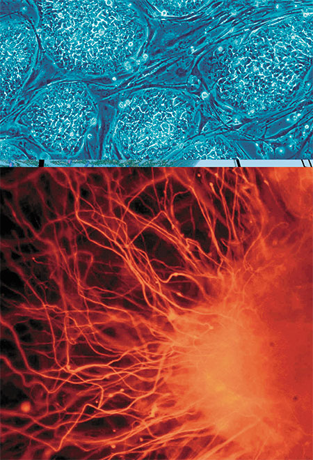 Эмбриональные стволовые клетки человека (вверху) и нейроны, образовавшиеся из этих клеток (внизу). © CC BY 2.5/Nissim Benvenisty