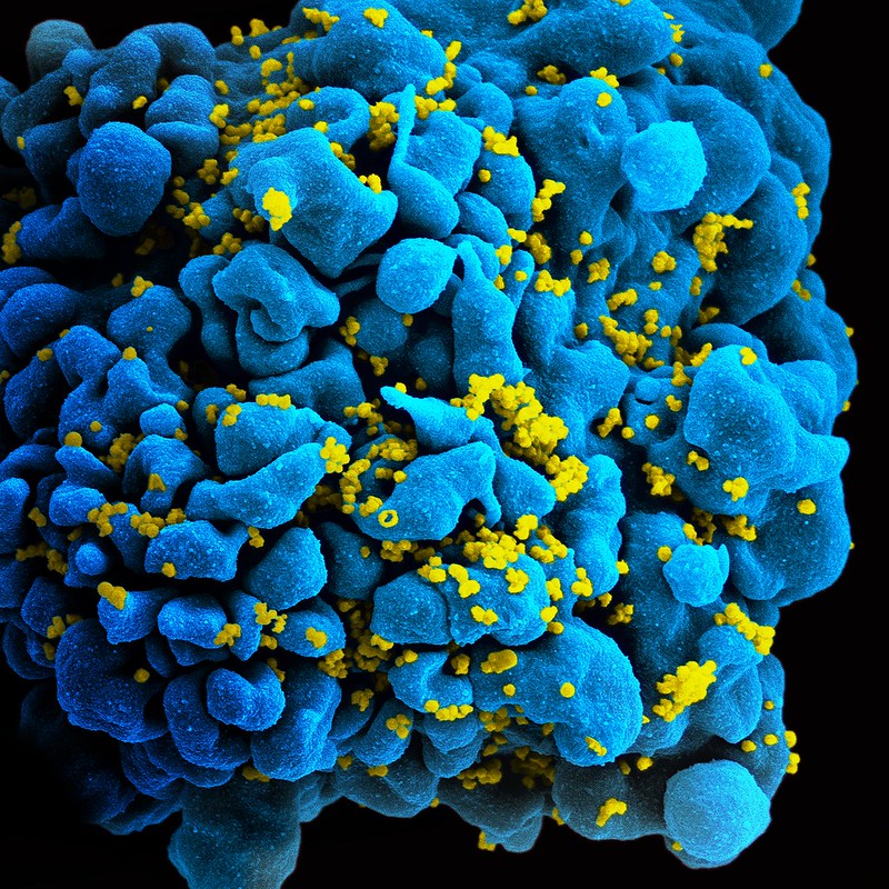 ВИЧ-инфицированный Т-лимфоцит. Желтым цветом отмечены вирусные частицы. Сканирующая электронная микроскопия. ©: NIAID