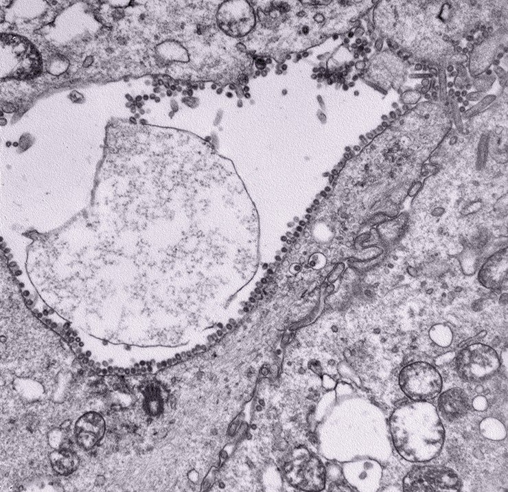На фотографии, полученной с помощью электронного микроскопа, отчетливо видны новые вирионы гриппа, которые почкуются, а затем «катапультируются» с поверхности зараженной и обреченной на гибель клетки. Фото Е. Рябчиковой (НХБФМ СО РАН, Новосибирск)