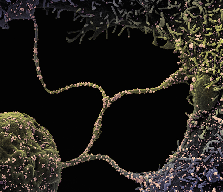 Эти клетки лабораторной культуры Vero CCL81CCL-81, полученные из эпителия почки африканской зеленой мартышки, инфицированы вирусными частицами SARS-CoV-2 (отмечены бежевым цветом). Щупальцевидные выступы, отходящие от зараженных клеток, прикрепляются к соседним клеткам и служат своего рода «мостом» для передачи вирусной инфекции. Сканирующая микроскопия. © NIAID