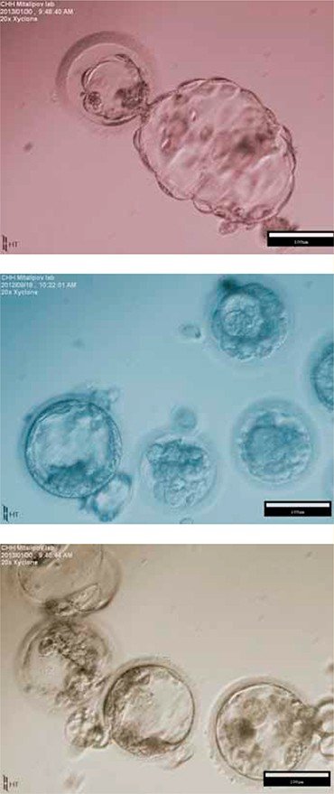 На этих уникальных фотографиях представлены бластоцисты – результат дробления яйцеклетки на ранней стадии развития зародыша млекопитающего. Для получения яйцеклеток использовалась методика переноса ядра соматических клеток. Такие клонированные человеческие эмбрионы можно использовать для приготовления линий стволовых клеток, ориентированных на конкретного пациента. Credit: Shoukhrat Mitalipov, Oregon National Primate Research Center, Oregon Health & Science University