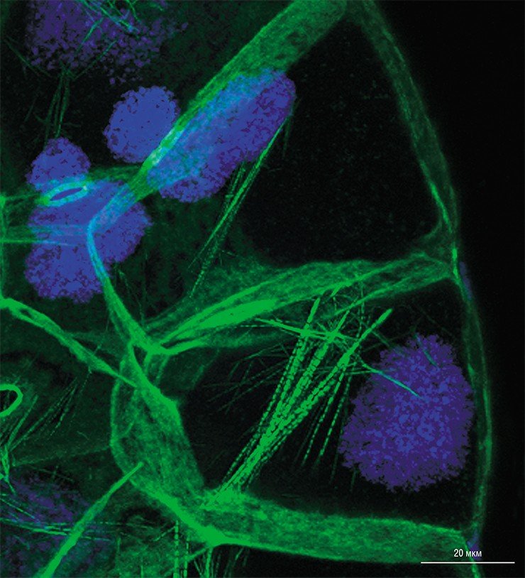 На фотографии показана часть яйцевой камеры мутантной мушки дрозофилы. Мутация приводит к нарушению формирования цитоплазматических актиновых нитей-филаментов, которые в норме предотвращают попадание ядер в кольцевые каналы. Незакрепленные ядра «проползают» в каналы, что приводит к нарушению тока питательных веществ в ооцит. Синим цветом окрашены ядра питающих клеток, зеленым – актиновые филаменты