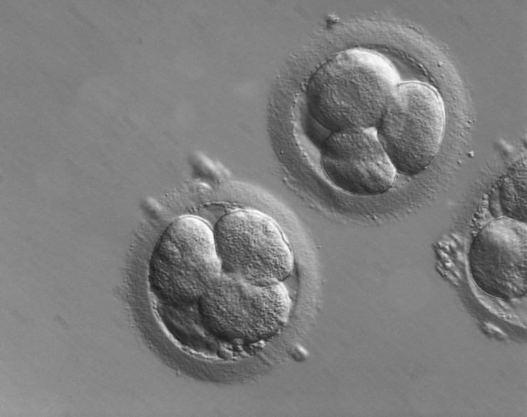 Человеческие эмбрионы на ранней стадии развития. Изображение получено в процессе процедуры ЭКО. ZEISS Microscopy 