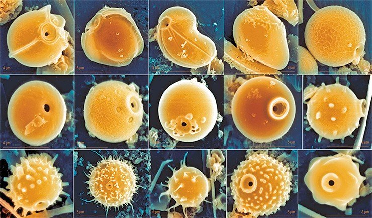 Стоматоцисты золотистых водорослей имеют прочную оболочку из кремния с одним отверстием, которое с возрастом закупоривается полисахаридной пробочкой. Форма цист самая разнообразная, но в основном сферическая с различными выростами. При прорастании цист пробочки растворяются и протопласт выходит в воду в виде монады или амебы. Сканирующая электронная микроскопия. Фото Е. Митрофановой