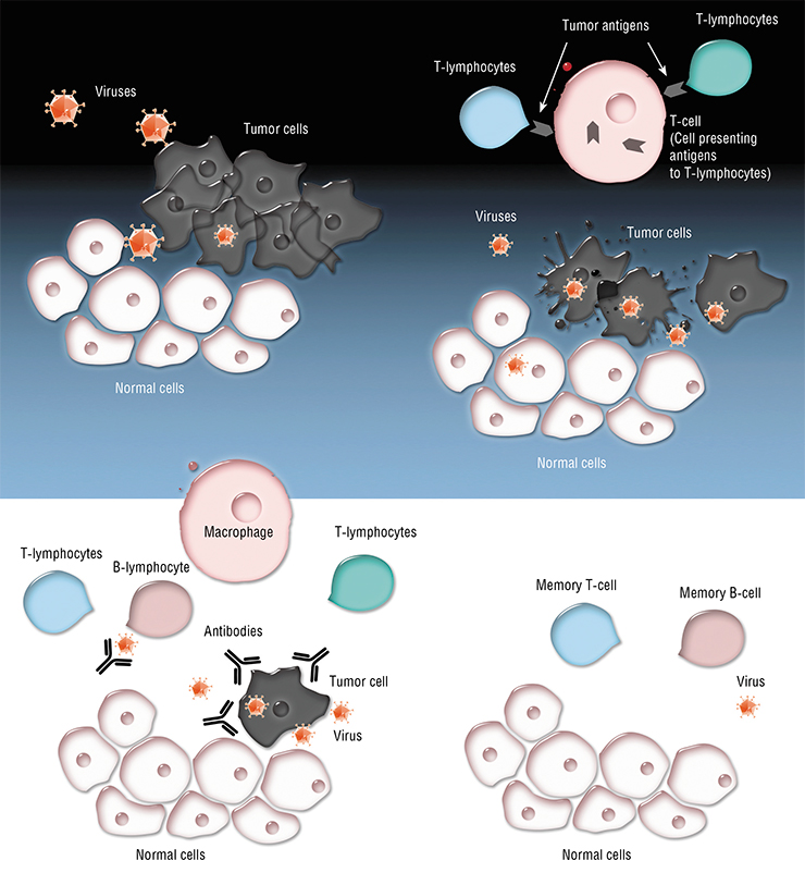 Today we know that the mechanism of action of oncolytic viruses is considerably more complex than simple lysis (destruction) of tumor cells. It has been established that the destruction process is accompanied by release of a number of tumor antigens and “danger” factors, which “awakens” cells of the immune system, which in turn begins a sort of a military campaign against the tumor. In addition to activation of the cellular part of the immune response, the virus activates other molecules, too, such as pro-inflammatory cytokines; as the result, the immune system is activated so powerfully that it may lead to the destruction not only of the primary tumor injected with the virus, but also of its metastases (Matveeva et al., 2015)