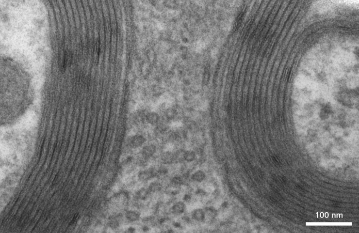 Миелиновая оболочка в ткани мозга мыши. Ультратонкий срез. © CC BY-NC-ND 2.0/ ZEISS Microscopy