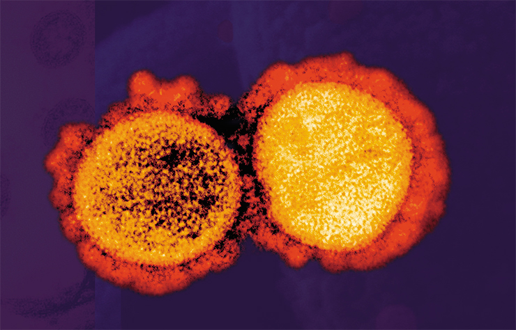 На вирусных частицах SARS-CoV-2 хорошо видны шиповидные S-белки, от которых вирус и получил свое название. Просвечивающая электронная микроскопия. © NIAID