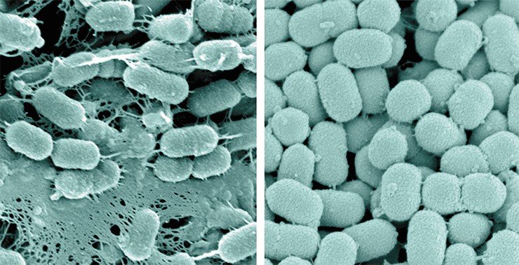 Так выглядят под электронным микроскопом бактерии рода Prevotella – одного из трех микроорганизмов, определяющих энтеротип человека. Один из штаммов этих бактерий (слева) образует своеобразные «сеточки», возможно, помогающие прикрепляться к стенкам кишечника. Другой, справа – не образует, что не мешает бактериям процветать в нашем кишечнике