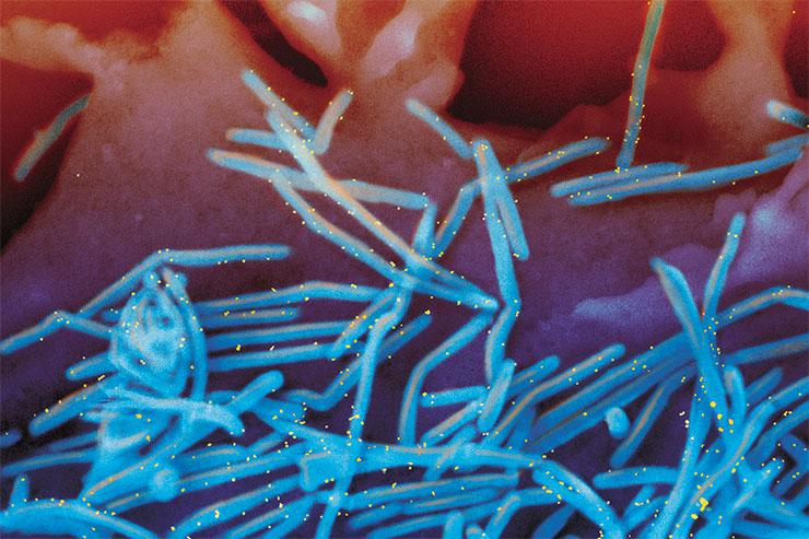  Вирионы респираторно-синцитиального вируса (РСВ) человека на поверхности эпителиальных клеток легких, помеченные антителами (желтым цветом). © CC BY-NC 2.0/National Institute of Allergy and Infectious Diseases, NIH