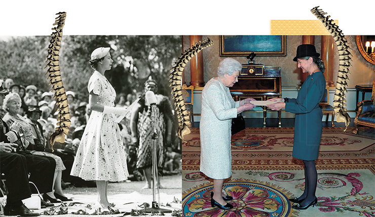 Характерные изменения осанки при остеопорозе можно проследить по фотографиям Елизаветы II, королевы Великобритании. На снимке, сделанном в Новой Зеландии в 1953 г. (слева), шейный, поясничный и грудной отделы позвоночника молодой стройной женщины находятся на одной линии. А на фото, сделанном 64 года спустя (справа), хорошо заметно остеопоротическое изменение осанки, служащее одним из первых проявлений этой болезни. © CC BY 2.0. Some rights reserved by Archives New Zealand и © CC BY 2.0. Some rights reserved Gareth Fuller/PA Wire
