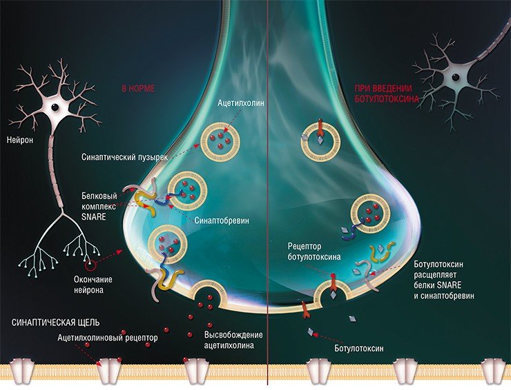 Действие ботулотоксина основано на прерывании работы химического синапса (межклеточного контакта) между нервным окончанием и мышечной клеткой-мишенью. В норме передача сигнала от нейрона к клетке происходит путем выброса нейромедиатора ацетилхолина, «упакованного» в особые мембранные пузырьки-везикулы. Выброс происходит после слияния мембраны пузырька с мембраной нейронов – этот процесс контролируется комплексом специальных белков (SNAP-25, синтаксин и синаптобревин). Высвободившийся ацетилхолин связывается с рецепторами на поверхности мышечной клетки, заставляя ее сокращаться, и вызывает изменение проводимости его оболочки. Ботулотоксин разрушает белковый SNAP-комплекс: тяжелая цепь, связываясь с мембраной, обеспечивает проникновение молекулы в нейрон, а легкая цепь разрушает один из специфических белков в зависимости от типа токсина. В результате высвобождение ацетилхолина в синаптическую щель блокируется, и сигнал от нейрона на мышечное волокно не передается. По: (Dickerson and Janda, 2006)