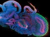 Органоид человеческого мозга вырастили под черепной крышкой обыкновенной мыши