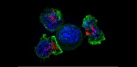«Обученные» иммунные клетки-киллеры спасли больную раком груди в терминальной стадии