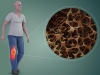 Хочешь прочные кости без остеопороза – живи в теплом климате!