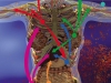 Ruled by the tumor: why are metastases so hard to suppress?