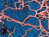 Виновниками хронического клещевого боррелиоза могут быть уже убитые бактерии