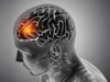 Воспаление в мозге как фактор риска суицида