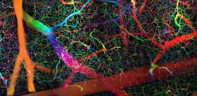 Визуализация потоков кислорода в мозге выявила опасные «гипоксические карманы»