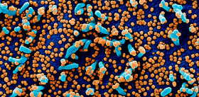 Человек с подавленным иммунитетом – арена для быстрой эволюции SARS-CoV-2