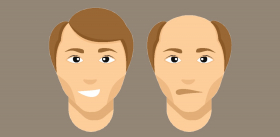 Изучение потери волос при стрессе привело к аутоиммунным процессам 