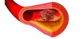 Модифицированные полисахариды из сибирской ели – против тромбов 